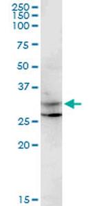 CENPP Antibody in Western Blot (WB)