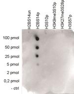 Phospho-Histone H2B (Ser14) Antibody in Peptide array (ARRAY)