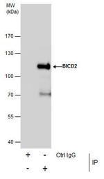 BICD2 Antibody in Immunoprecipitation (IP)
