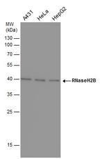 RNaseH2B Monoclonal Antibody (3I4)