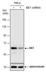 ME1 Antibody in Western Blot (WB)