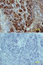 GLUT2 Monoclonal Antibody (199017)