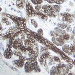 GLUT2 Antibody in Immunohistochemistry (Paraffin) (IHC (P))