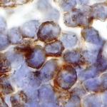 IL4R Antibody in Immunohistochemistry (Paraffin) (IHC (P))