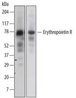 EpoR Monoclonal Antibody (38409)