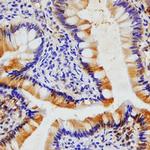 Eotaxin Monoclonal Antibody (43911)