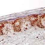 CCL27 Antibody in Immunohistochemistry (Paraffin) (IHC (P))