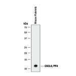 PF4 Monoclonal Antibody (140910)