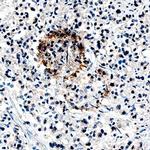 Angiopoietin 1 Monoclonal Antibody (171718)