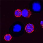 TREM1 Monoclonal Antibody (174031)