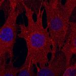 CD105 Monoclonal Antibody (209701)