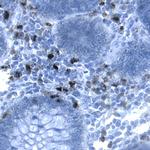 CEACAM1 Monoclonal Antibody (283324)