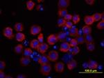 GP130 Antibody in Immunocytochemistry (ICC/IF)