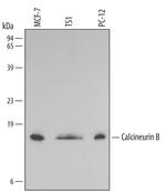 Calcineurin B Monoclonal Antibody (212306)