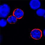 IL-6 Receptor Monoclonal Antibody (255820)