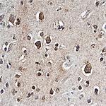 PTPRZ Monoclonal Antibody (279245)