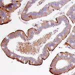 MEP1B Monoclonal Antibody (289731)