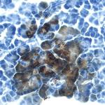 REG3B Monoclonal Antibody (293523)