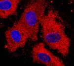 DSPG3 Monoclonal Antibody (329707)