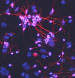 Meteorin Monoclonal Antibody (347505)