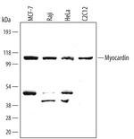 MYOCD Monoclonal Antibody (355521)