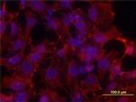 S100P Monoclonal Antibody (357517)