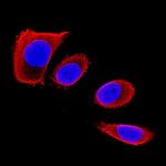 Chondrolectin Antibody in Immunocytochemistry (ICC/IF)