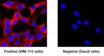 CADM4 Monoclonal Antibody (404619)