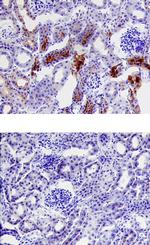 PRSS3 Monoclonal Antibody (419911)