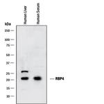 RBP4 Antibody in Western Blot (WB)
