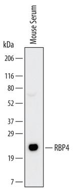 RBP4 Antibody in Western Blot (WB)