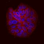 ITGB6 Antibody in Immunocytochemistry (ICC/IF)