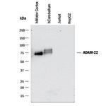 ADAM22 Monoclonal Antibody (498805)