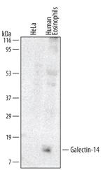 Galectin 14 Monoclonal Antibody (511124)