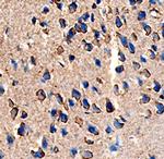 ANGPTL7 Monoclonal Antibody (538401)