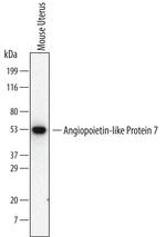 ANGPTL7 Antibody in Western Blot (WB)