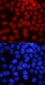 PYGO2 Monoclonal Antibody (539730)