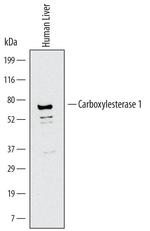 CES1 Monoclonal Antibody (544623)
