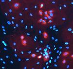 Laminin alpha-3 Monoclonal Antibody (546215)