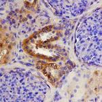 ADAMTS15 Monoclonal Antibody (561819)