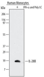 IL-28B Monoclonal Antibody (567143)
