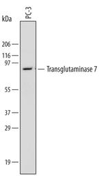TGM7 Monoclonal Antibody (602708)