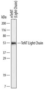 C. tetani TeNT Light Chain Monoclonal Antibody (604023)