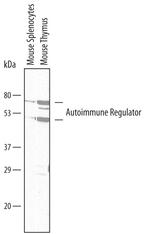AIRE Monoclonal Antibody (609930)