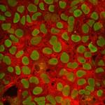 FBXO15 Monoclonal Antibody (612834)