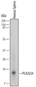 PLA2G2A Monoclonal Antibody (620501)
