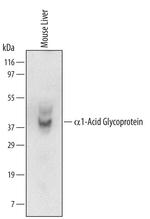Orm1 Monoclonal Antibody (628110)
