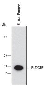 PLA2 Antibody in Western Blot (WB)
