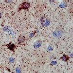 SULT1A1 Monoclonal Antibody (638708)