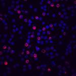 CFHR4 Monoclonal Antibody (640212)